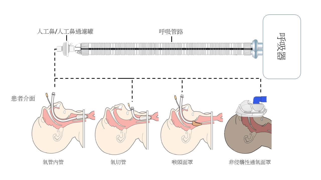 呼吸器示意圖