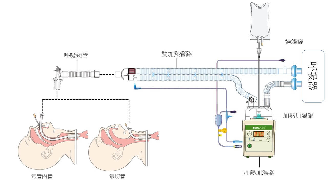 呼吸管路示意圖